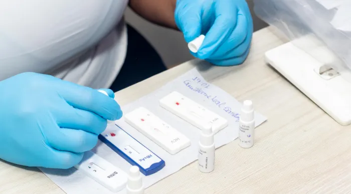 Unidade móvel realizou exames para detecção de HIV, sífilis e hepatites B e C / Fotos: Mário Sousa